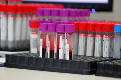 Akcija-OBZ-AnaRukavina-04